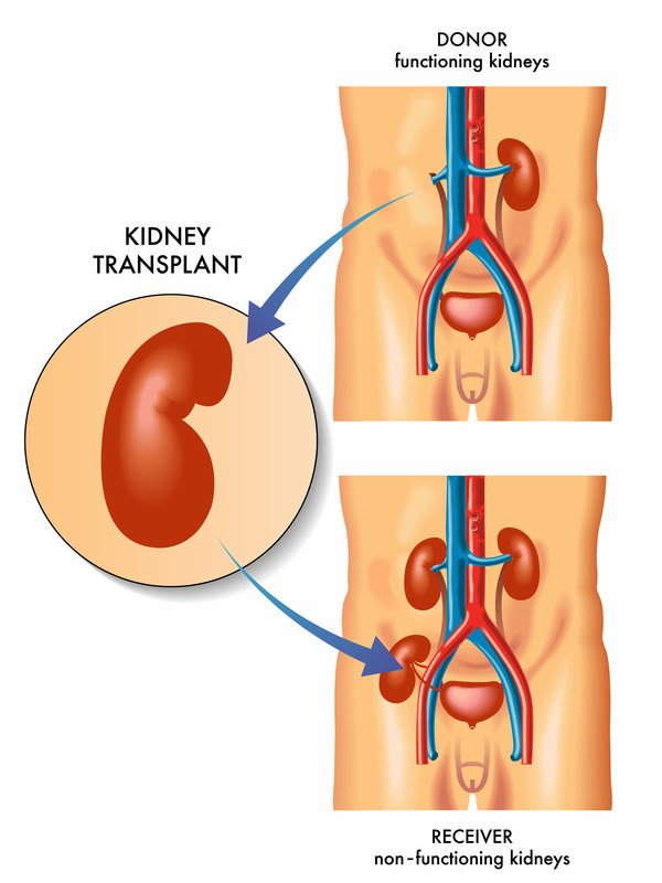 Kidney Doctor